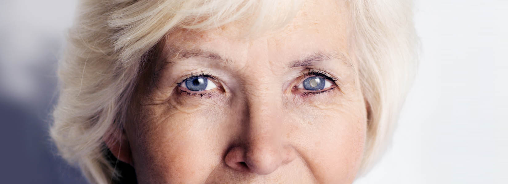 Cataract Surgery in Greenville